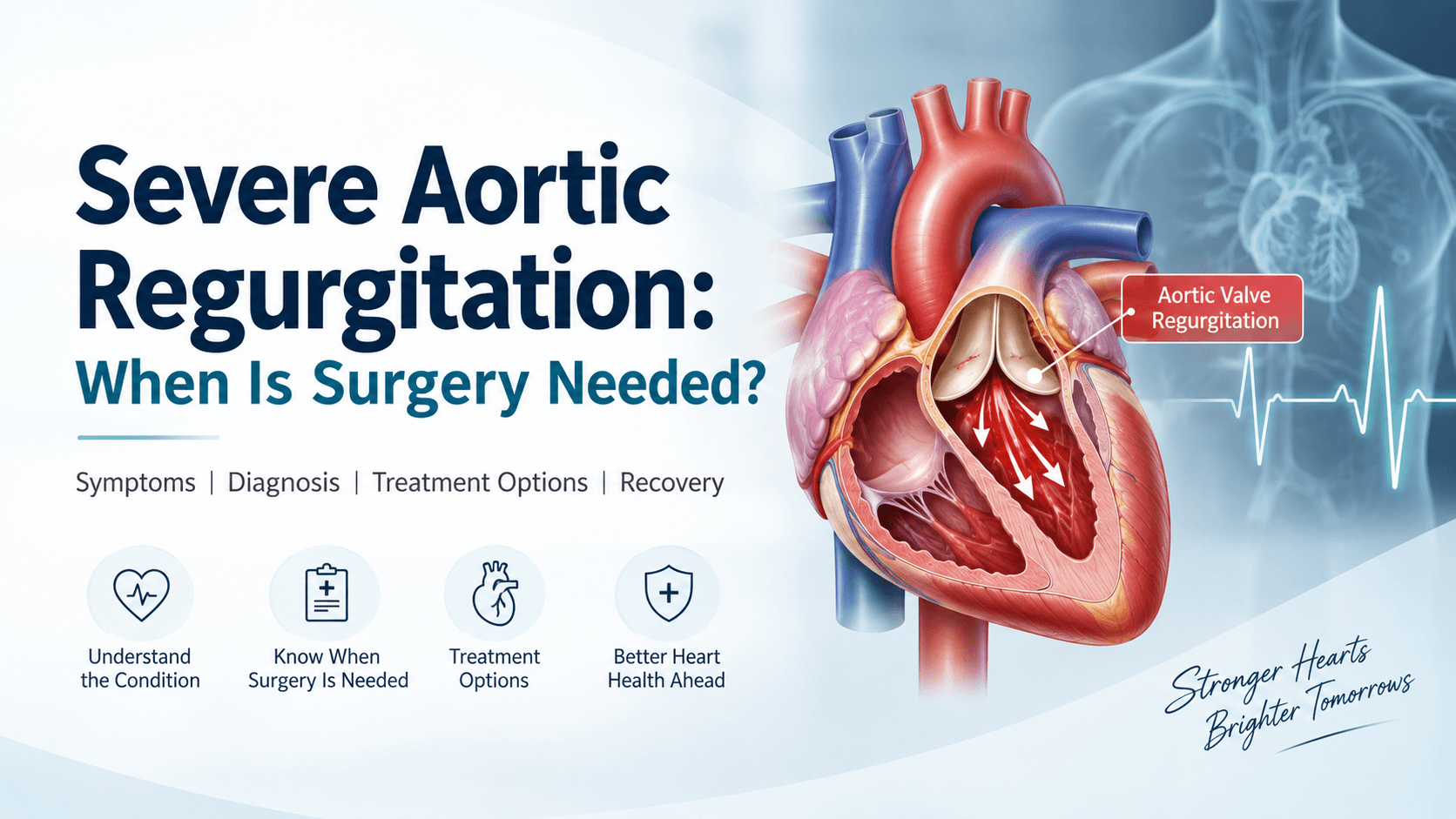 Severe Aortic Regurgitation Explained — a cutaway illustration of the heart and the leaking aortic valve